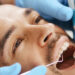 How Dentists Approach Oral Desquamative Lesions in Patients