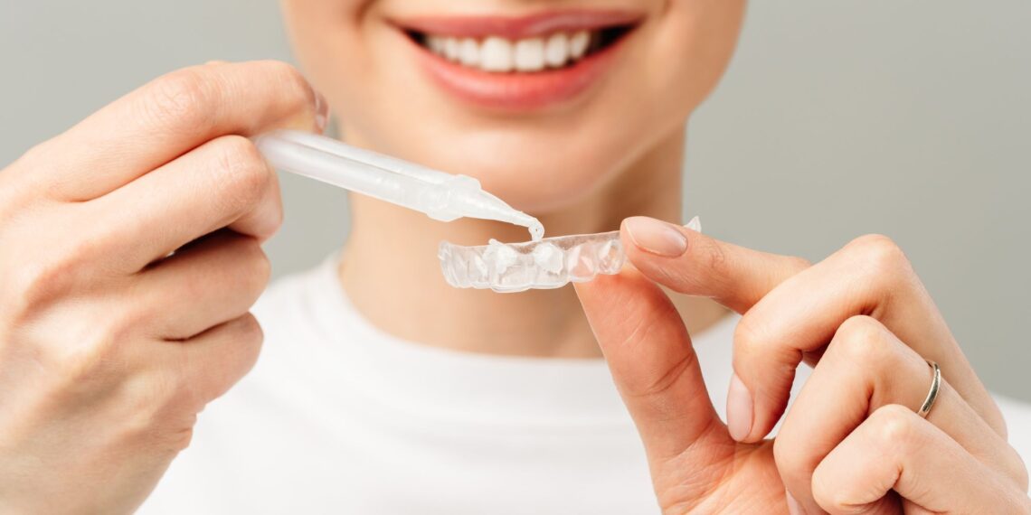 Teeth Whitening Innovations: Beyond Bleaching Gels and Trays