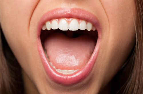 Artificial saliva gels providing relief for chronic dry mouth and xerostomia.