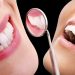 Smiling woman showing off white teeth after veneers vs bonding treatment