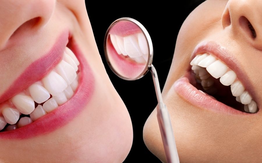 Smiling woman showing off white teeth after veneers vs bonding treatment